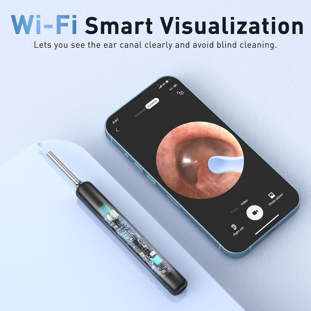 Electric Ear Wax Removal Kit – 1080P Camera